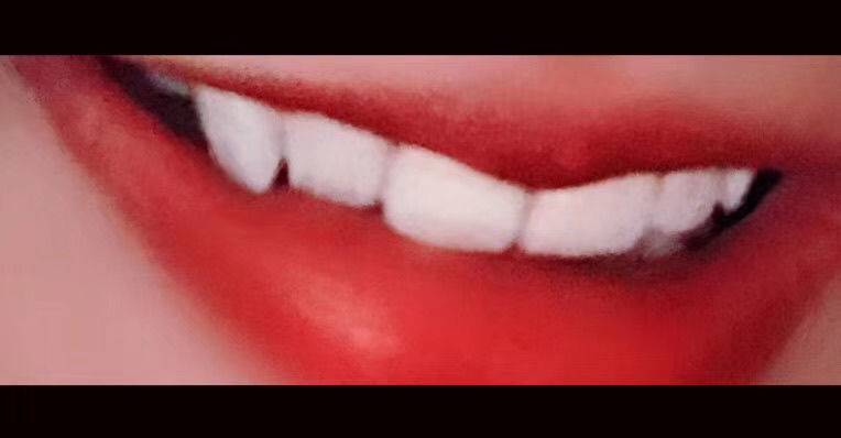 翅翅