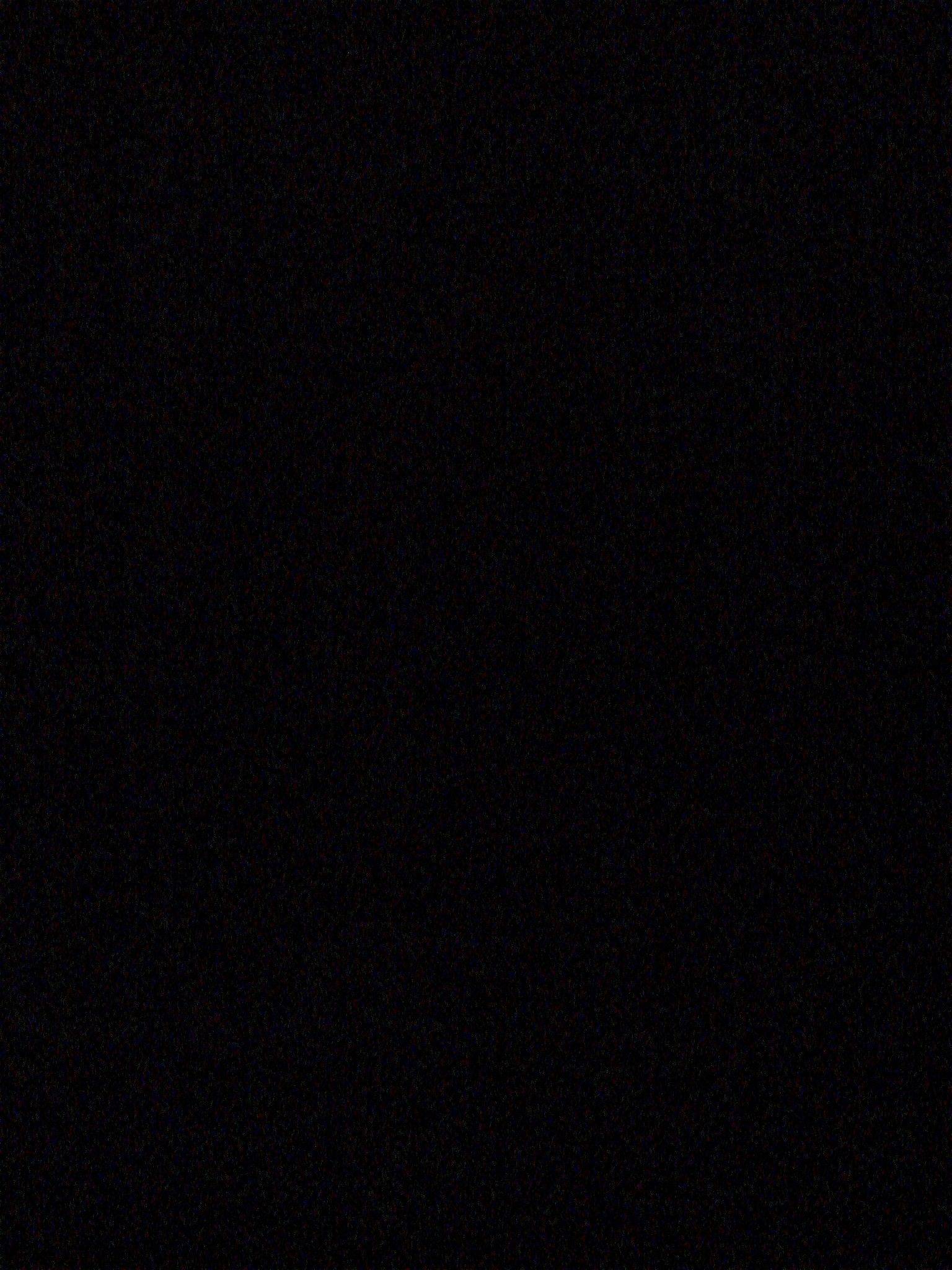 Xt 